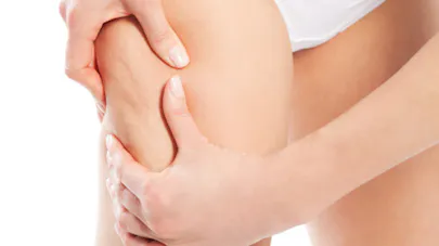 Cellulite 15 Jours Chrono Pour Vous Affiner Du Bas Sante Magazine