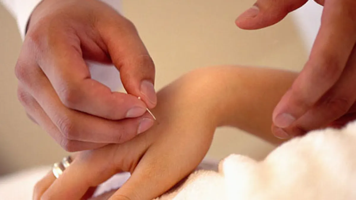 Augmenter Ses Chances De Grossesse Avec L Acupuncture Sante Magazine Augmenter Ses Chances De Grossesse Avec L Acupuncture Sante Magazine