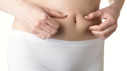 Abdominoplastie : pour retrouver un ventre plat