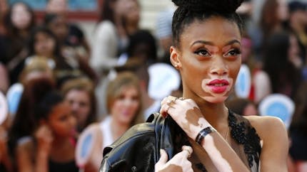 Atteinte de vitiligo, Winnie Harlow est aussi mannequin
