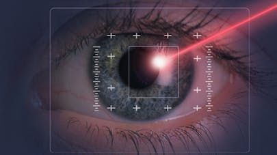 Chirurgie Des Yeux Les Progres Du Laser Sante Magazine