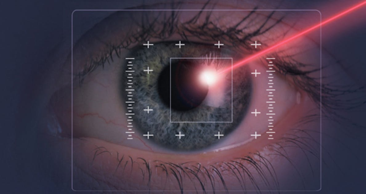 opérations au laser yeux