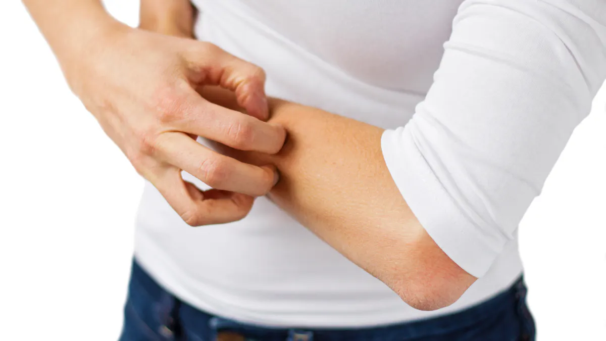 Quel Traitement Contre La Gale Sante Magazine Quel Traitement Contre La Gale Sante Magazine