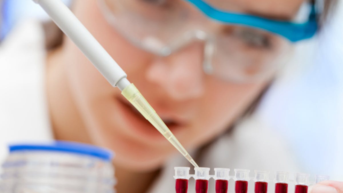 Analyse De Sang Standard Sante Magazine Analyse De Sang Standard Sante Magazine