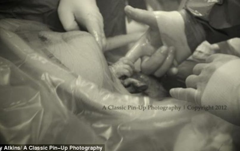 Le Bebe Tient Le Doigt Du Chirurgien Lors De La Cesarienne Sante Magazine Le Bebe Tient Le Doigt Du Chirurgien Lors De La Cesarienne Sante Magazine