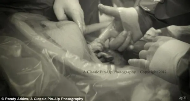 Le Bebe Tient Le Doigt Du Chirurgien Lors De La Cesarienne Sante Magazine