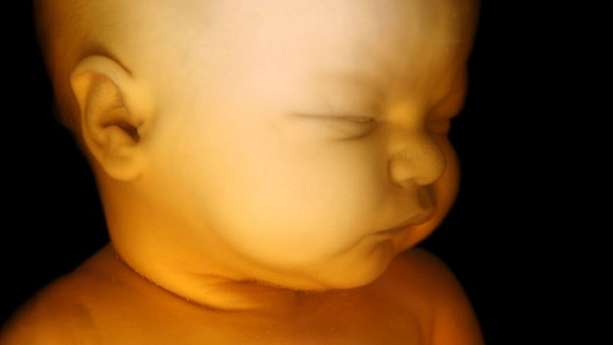 Le visage du fœtus peut exprimer la douleur