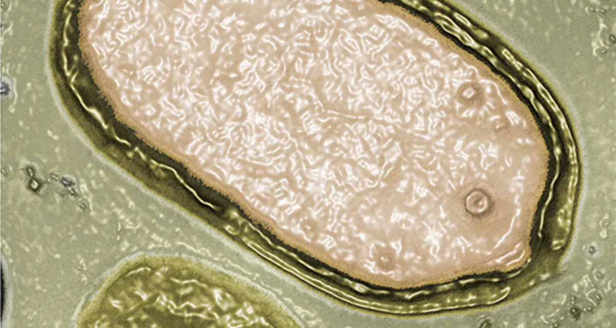 Pandoravirus : la découverte de deux virus géants bouleverse le monde ...
