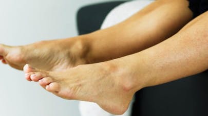 Chaleur Jambes Lourdes Attention Aux Phlebites Sante Magazine