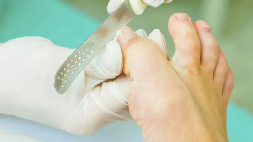 Podologue : pourquoi le consulter ?