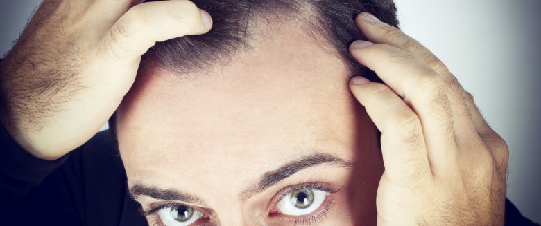 Alopecie Un Medicament Anticancereux Fait Repousser Les Cheveux Sante Magazine