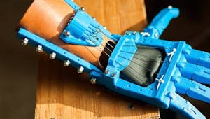 Impression 3D : première prothèse de la main pour un jeune français