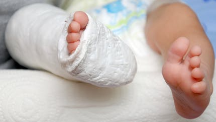 Maladie des os de verre : un espoir de traitement avant la naissance
