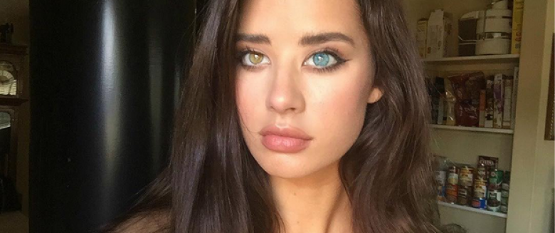 Une mannequin fait le buzz… grâce à ses yeux Santé Magazine