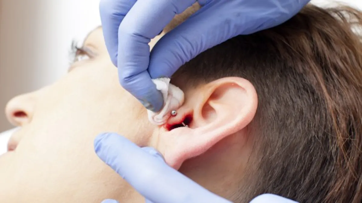 Le Piercing Au Cartilage De L Oreille Une Solution Anti Migraine Sante Magazine Le Piercing Au Cartilage De L Oreille Une Solution Anti Migraine Sante Magazine