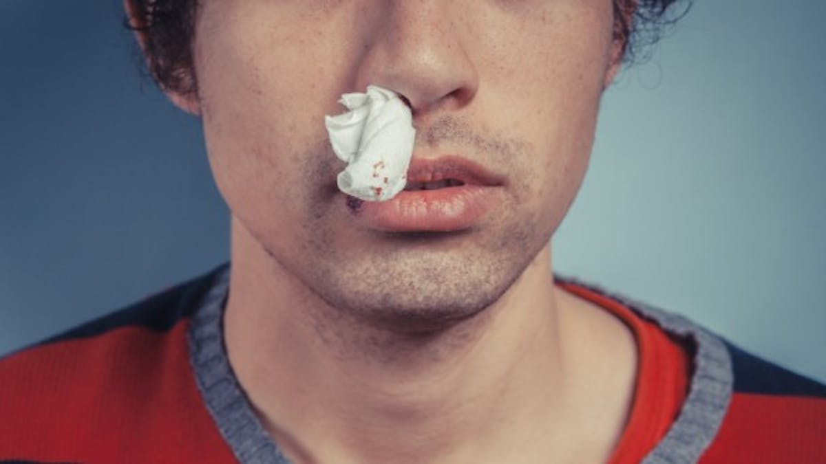 Tout Savoir Sur Le Saignement Du Nez Sante Magazine Tout Savoir Sur Le Saignement Du Nez Sante Magazine