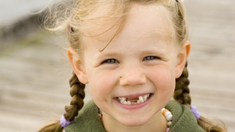 Ce que nos dents révèlent sur notre santé