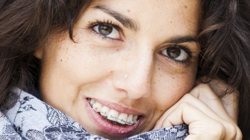 10 Choses A Savoir Sur L Orthodontie Pour Adultes Sante Magazine 10 Choses A Savoir Sur L Orthodontie Pour Adultes Sante Magazine