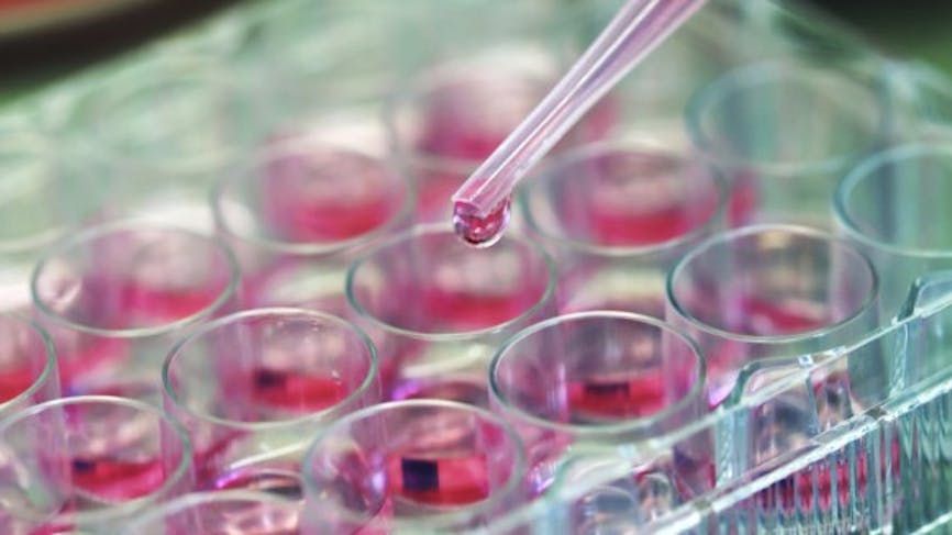 Cancer du sein : les chercheurs en savent plus sur la résistance aux traitements