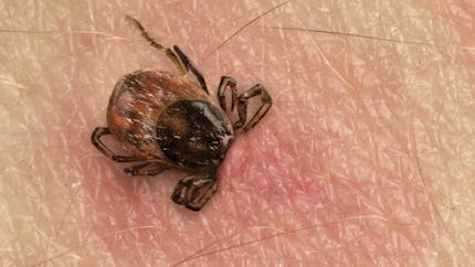 Maladie de Lyme : 150 patients portent plainte contre le test de diagnostic
