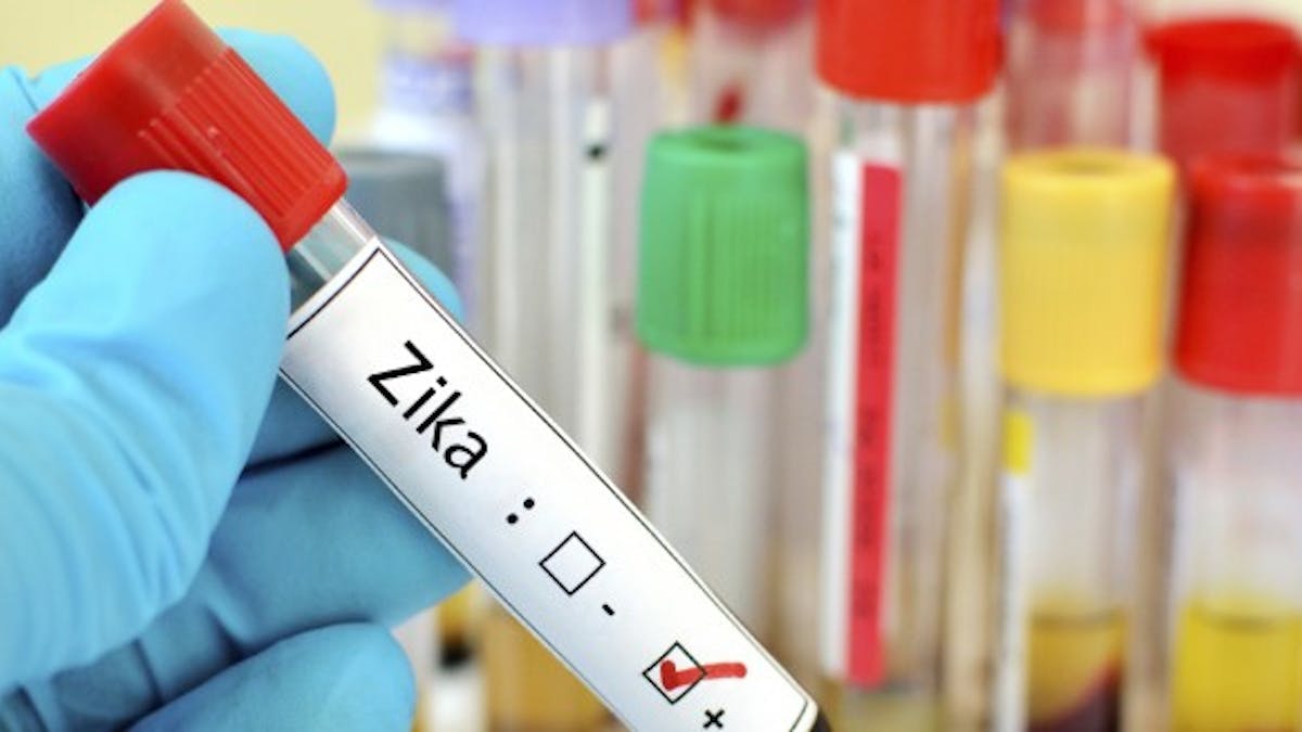 Zika : pas de relations sexuelles non protégées pendant huit semaines