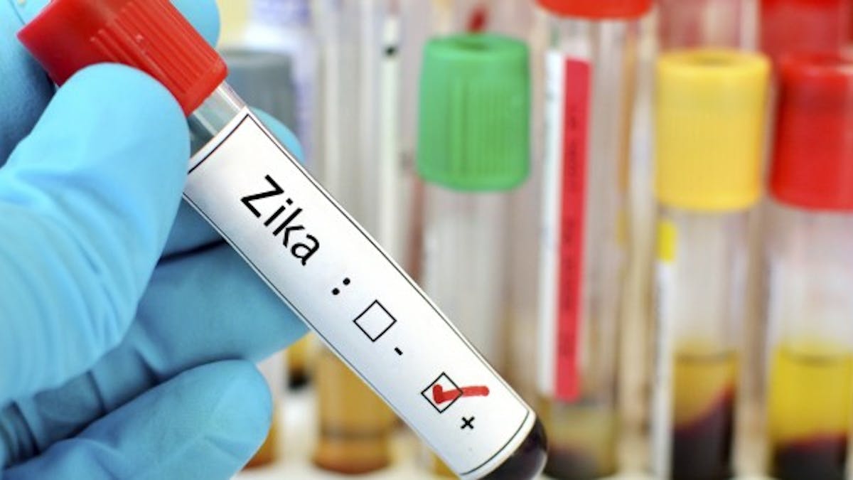 Zika : le virus se transmettrait aussi par sexe oral