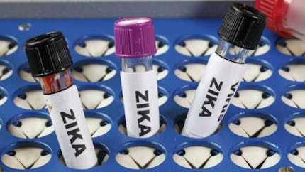 Zika : la FDA dit oui à un test de diagnostic rapide