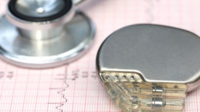 Pacemaker : comment marche ce stimulateur cardiaque ? | Santé Magazine
