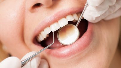 3 bons gestes pour éviter les caries