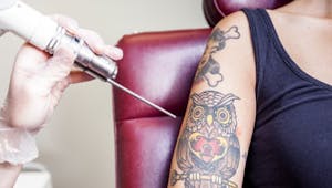 Comment faire enlever un tatouage ? Les recommandations américaines
