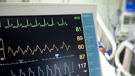 Un moniteur cardiaque connecté à un smartphone mis au point au CHRU de Lille