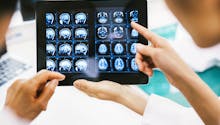 Qu'est-ce qu'une IRM cérébrale ?