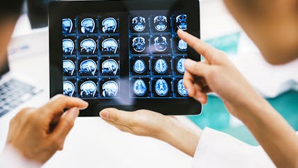 IRM cérébrale : 5 choses à savoir