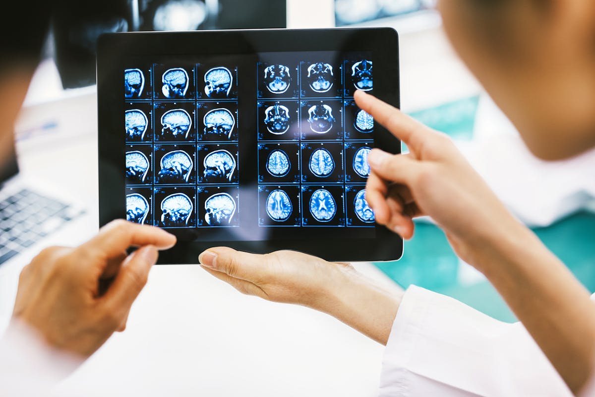 IRM cérébrale : définition, indications, déroulement | Santé Magazine