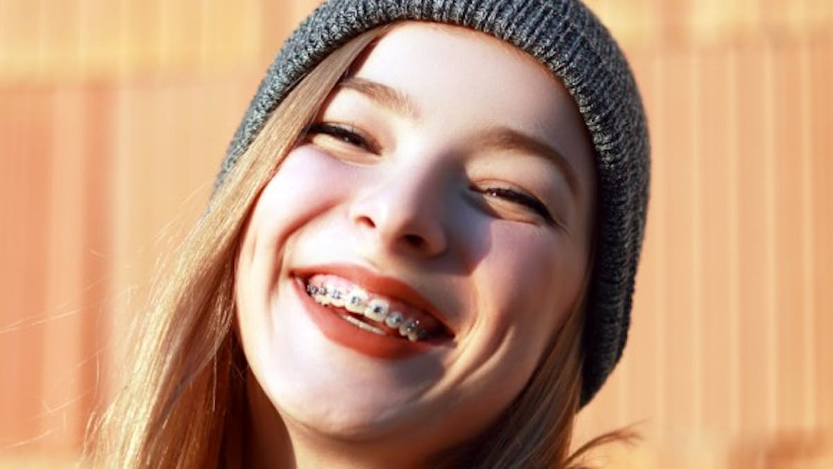 Comment Soigner Les Blessures Liees A Un Appareil Dentaire Sante Magazine Comment Soigner Les Blessures Liees A Un Appareil Dentaire Sante Magazine