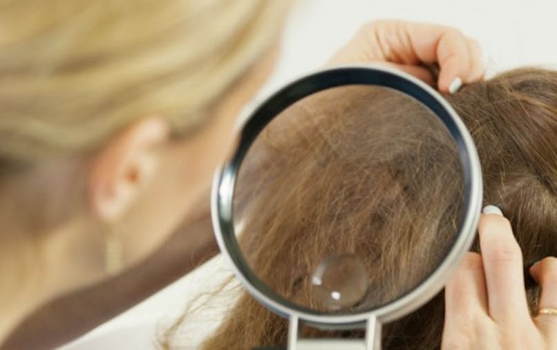 Poux Pourquoi Les Produits A Base D Huiles Essentielles Sont A Eviter Sante Magazine Poux Pourquoi Les Produits A Base D Huiles Essentielles Sont A Eviter Sante Magazine