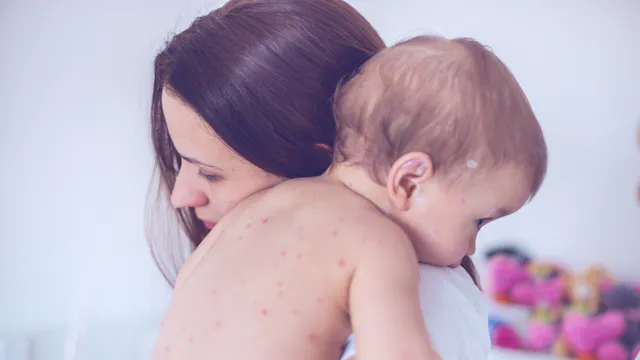 Meningite Boutons Rouges Symptômes de la méningite chez le bébé : savoir les reconnaître | Santé ...