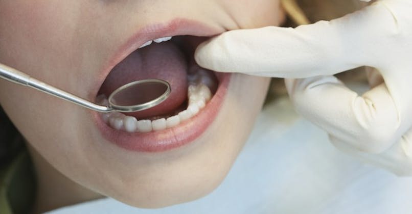 Les bactéries de la bouche seraient liées au cancer de l'œsophage