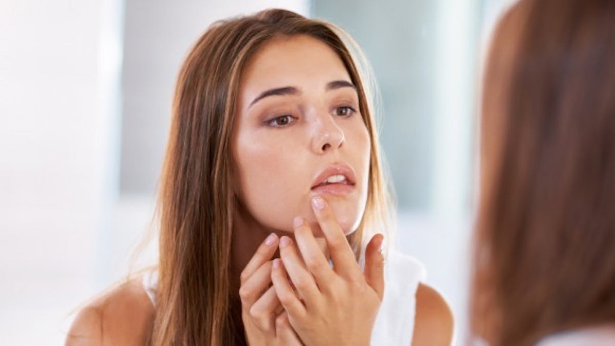 Comment Eliminer Un Bouton Avant Qu Il Apparaisse Sante Magazine Comment Eliminer Un Bouton Avant Qu Il Apparaisse Sante Magazine