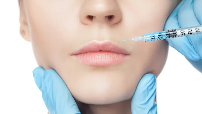 Injections Botox Et Acide Hyaluronique Sante Magazine