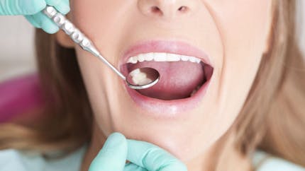 Les dents, clé du diagnostic précoce des troubles de l'alimentation