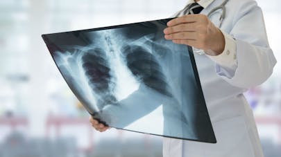Des patients reçoivent une trachée artificielle, une première mondiale française
