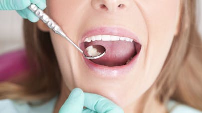 Vers une meilleure prise en charge des soins bucco-dentaires