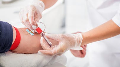 Mélanome : un test sanguin mis au point en Australie
