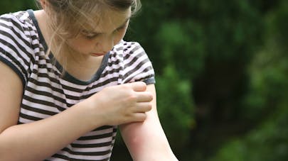 Moustique : trois personnes infectées par le virus West Nile à Nice