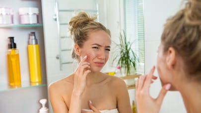 Comment aider votre ado qui souffre d'acné