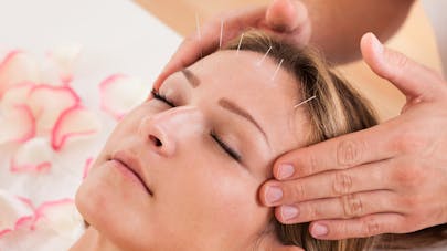 acupuncture