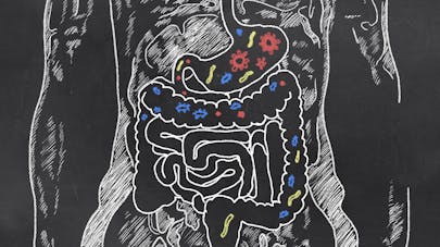 Quelles sont les causes de la maladie de Crohn ?