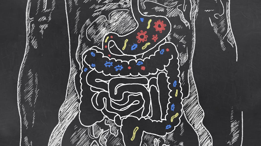 Qu’est-ce qui provoque la maladie de Crohn ?