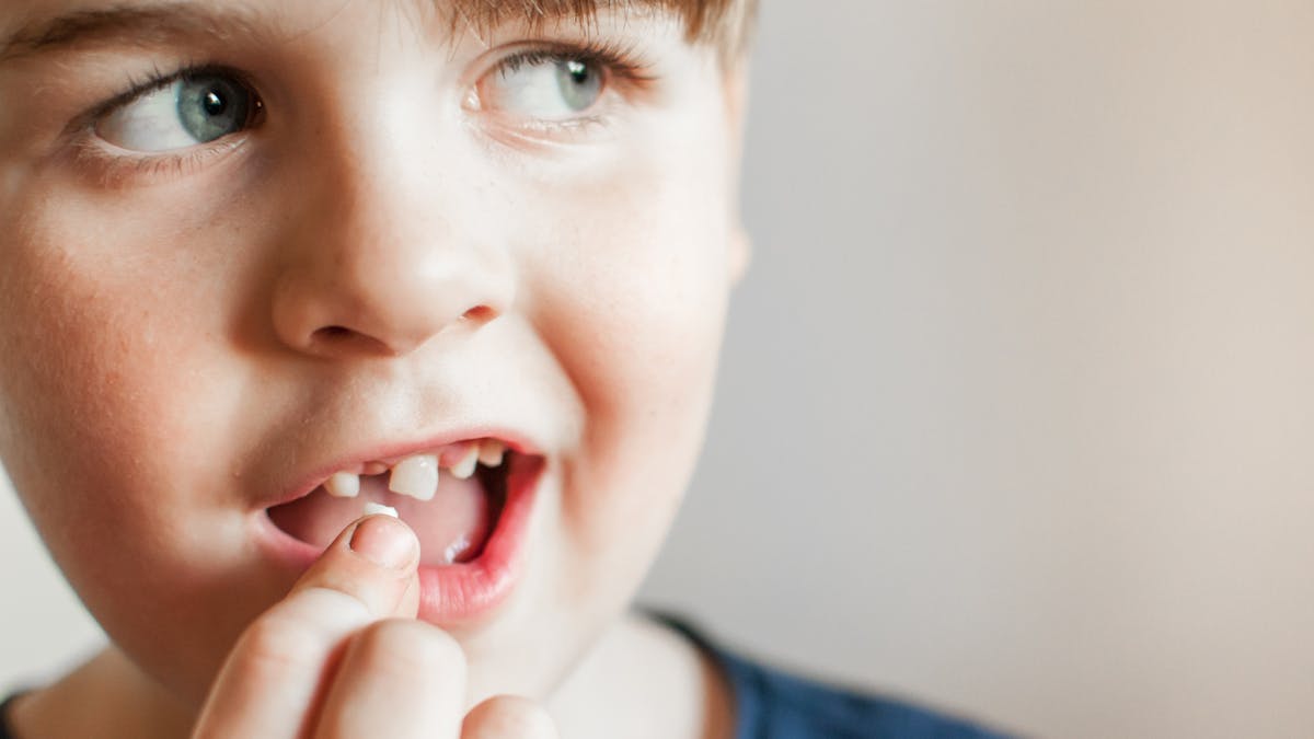 Dents De Lait Leurs Cellules Souches Pour Sauver La Vie Des Enfants Sante Magazine Dents De Lait Leurs Cellules Souches Pour Sauver La Vie Des Enfants Sante Magazine